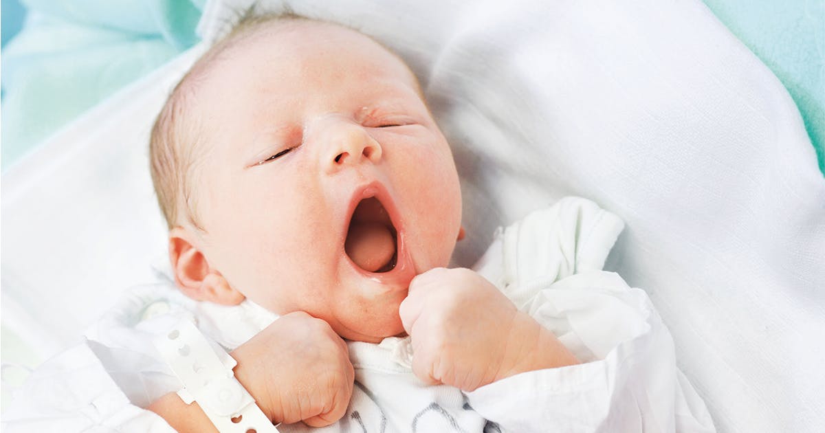 A yawning newborn baby with a hospital ID bracelet.