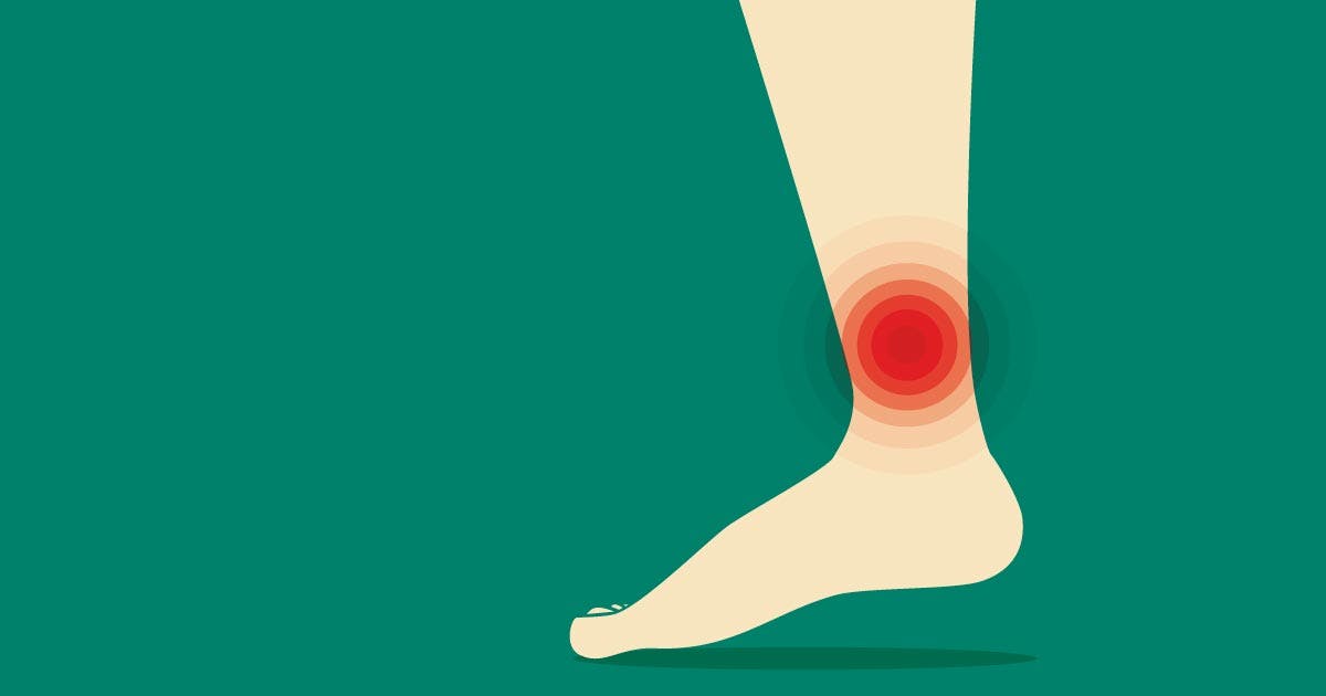 Lower leg with a radiating red spot on the ankle (illustration)