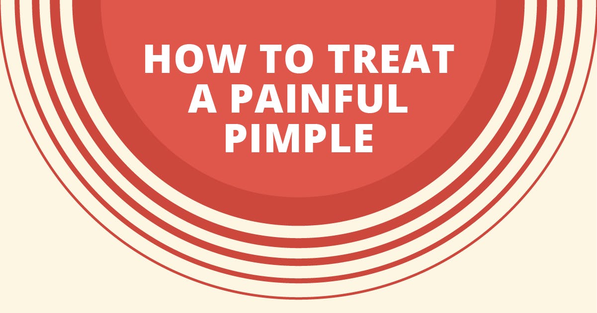 How to treat a painful pimple