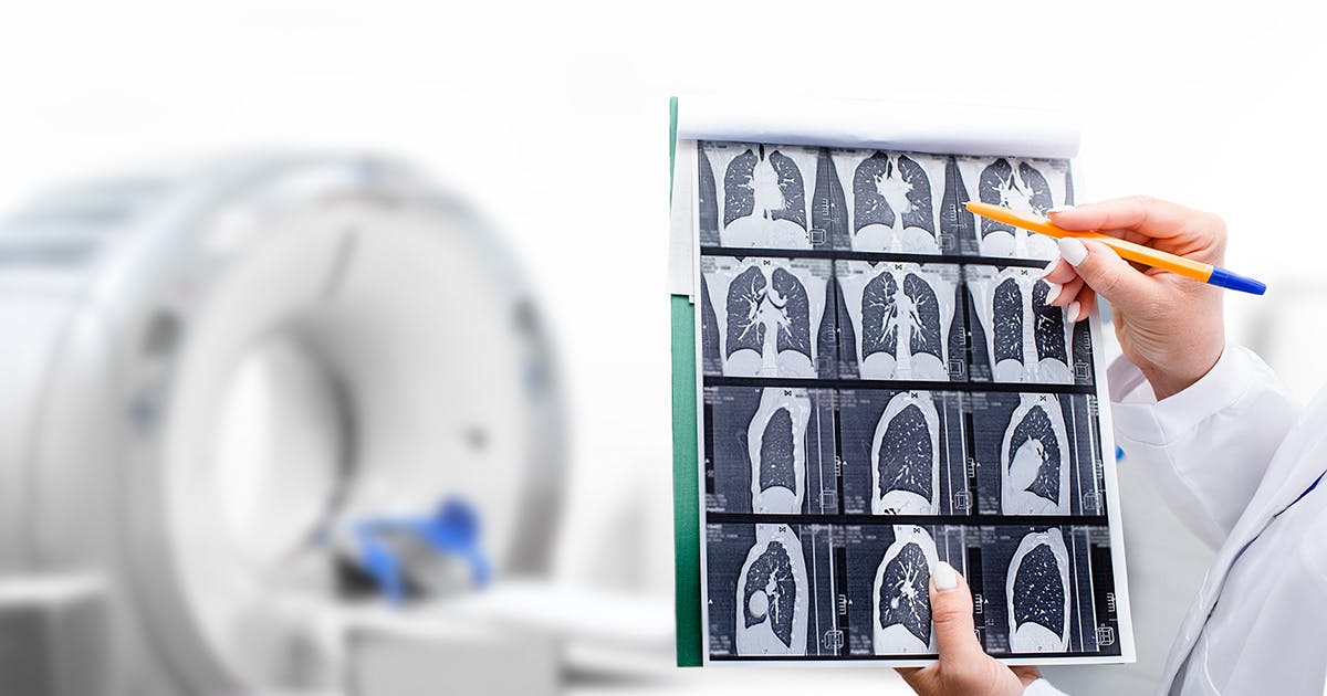 A doctor looks at images from a chest CT scan.